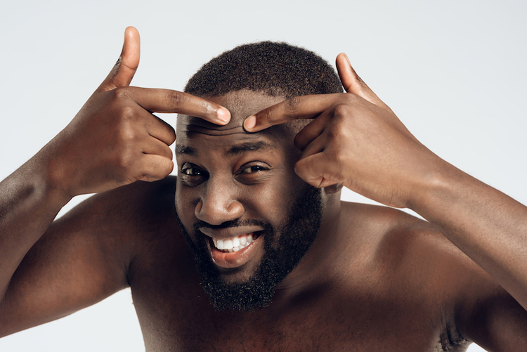 imperial touch ingrown hairs solution